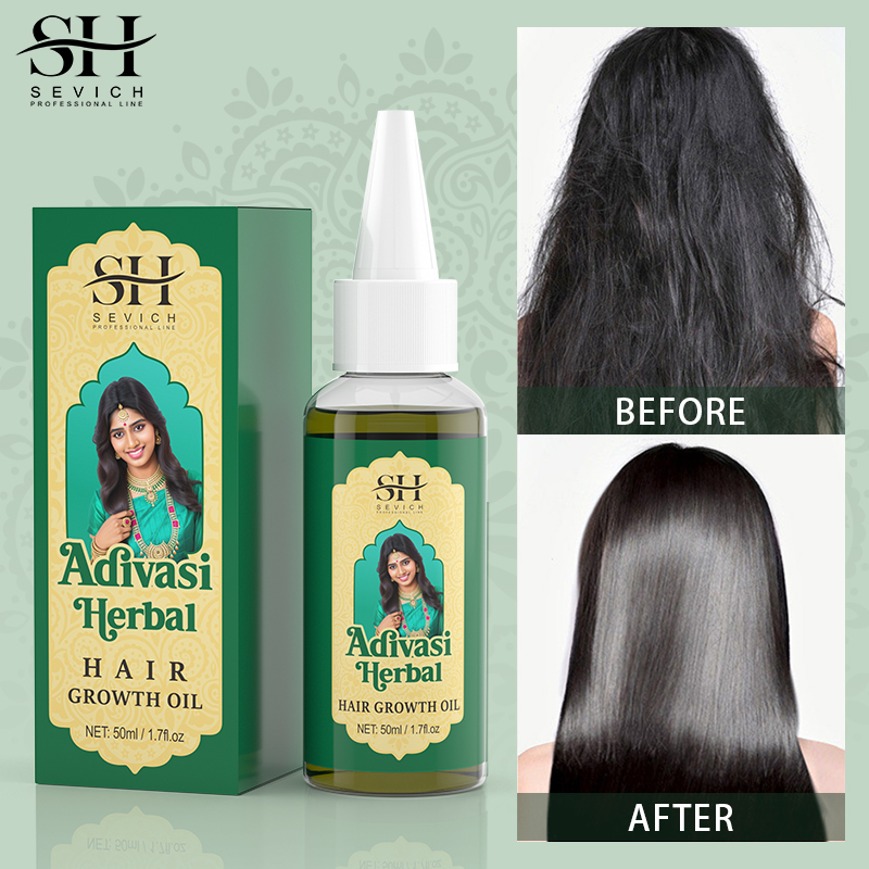 Sevich India Herbal Hair Growt - đánh giá và giá Ayurvedic & Herbal Wellness Kits